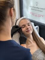 Karboksyterapia